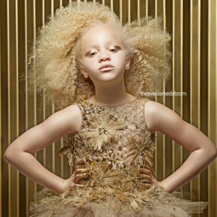 Ava_Clarke_modelo_albina_menina_08-768x768