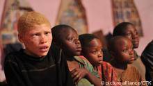albinos3
