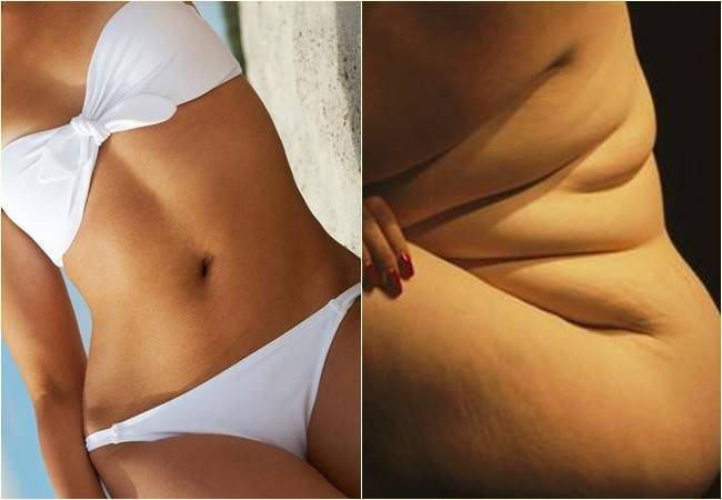 A ditadura do corpo perfeito