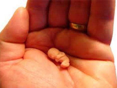 aborto