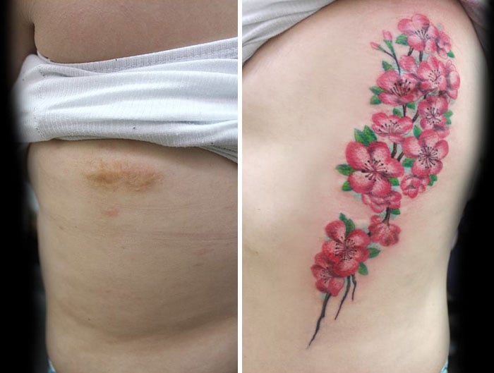 tatuagens-flavia-carvalho-de-sobreviventes-da-violencia-e-cancer-8